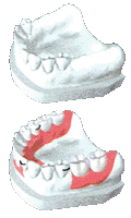 prtesis dental